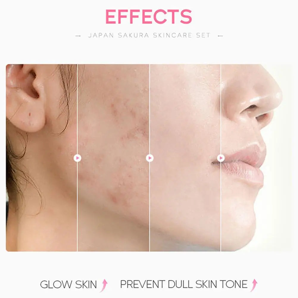5/3 pz/set Sakura Set Per La Cura Della Pelle Crema Per Il Viso Siero Toner Detergente Per Il Viso Crema Solare Crema Per Gli Occhi Confezione Regalo Viso Set Per La Cura Della Pelle Prodotto